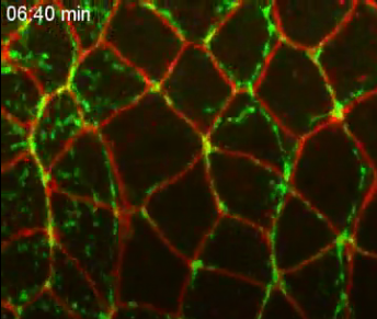 Movie link Myosin II